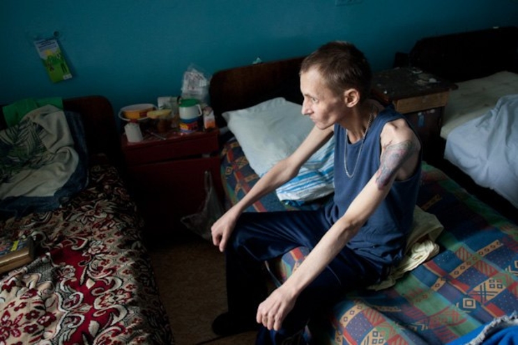 В Приднестровье ситуация с туберкулезом остаётся напряженной