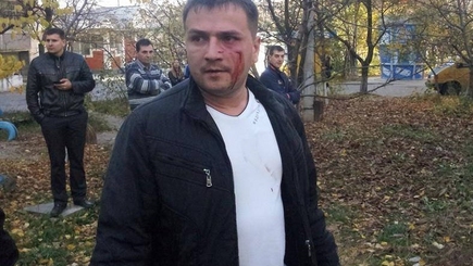 На Чеканах местные жители подрались с застройщиками