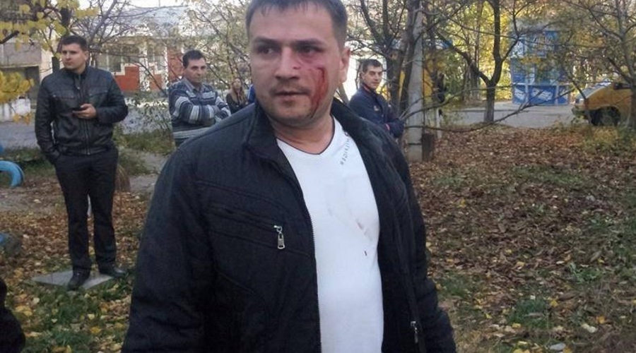 На Чеканах местные жители подрались с застройщиками