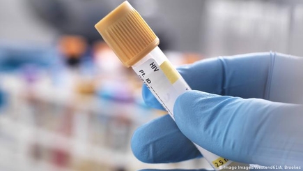 Самое главное о борьбе с ВИЧ в Германии