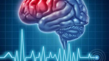 Каждый шестой житель РМ умирает от инсульта