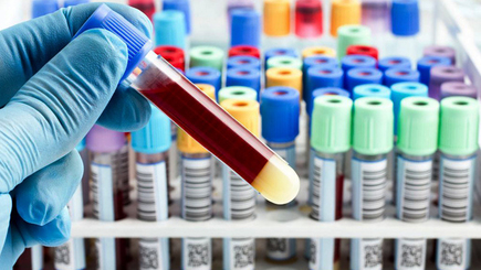 Корейские медики нашли коронавирус у вылеченных людей с антителами