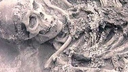 Коммунисты начали операцию «Красный хирург». Без наркоза…