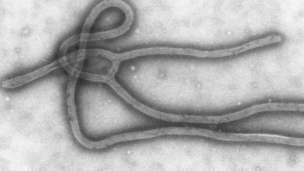 Под Новосибирском произошел взрыв в научном центре, где хранится вирус лихорадки Эбола