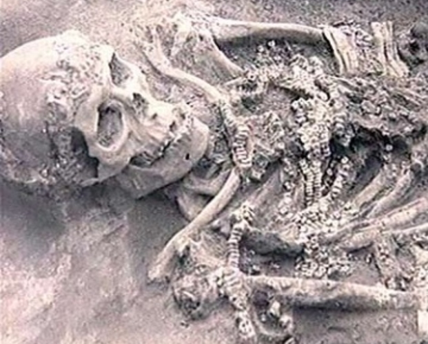 Коммунисты начали операцию «Красный хирург». Без наркоза…