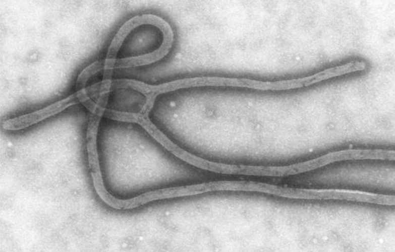 Под Новосибирском произошел взрыв в научном центре, где хранится вирус лихорадки Эбола