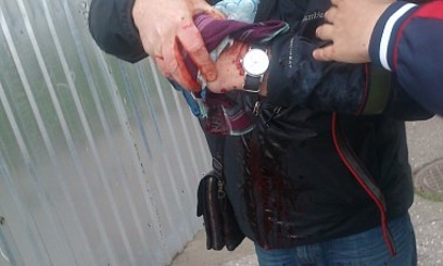 На митинге в Одессе взорвалась петарда: ранен мужчина