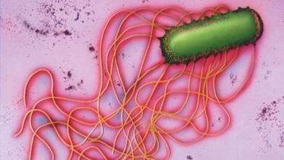 В селе Реча 22 человека попали в больницу с сальмонеллёзом