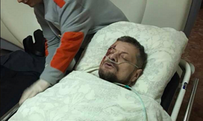 Теракт около канала Эспрессо в Киеве