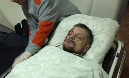 Теракт около канала Эспрессо в Киеве