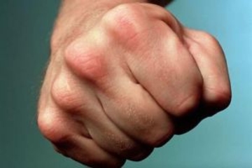 Дипломат из Нидерландов избит в Москве