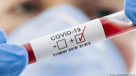 В Кишиневе введен оранжевый уровень эпидемиологической угрозы из-за COVID-19