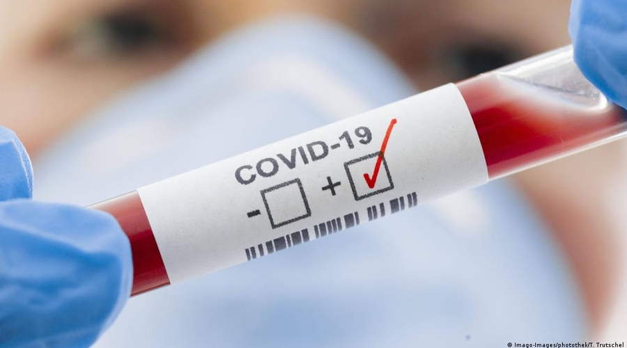 В Кишиневе введен оранжевый уровень эпидемиологической угрозы из-за COVID-19